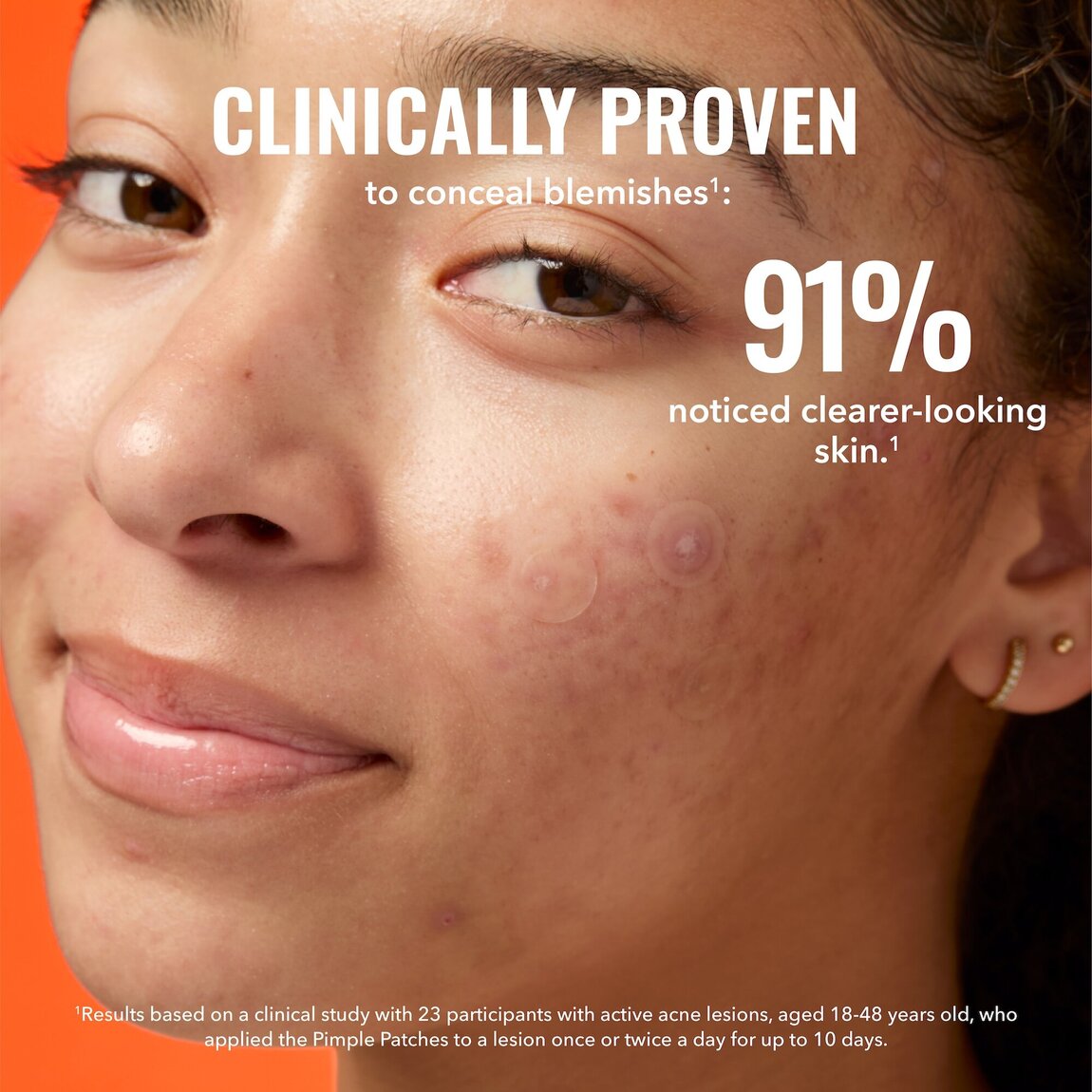 pimple-patches-f8 zb_p.jpg