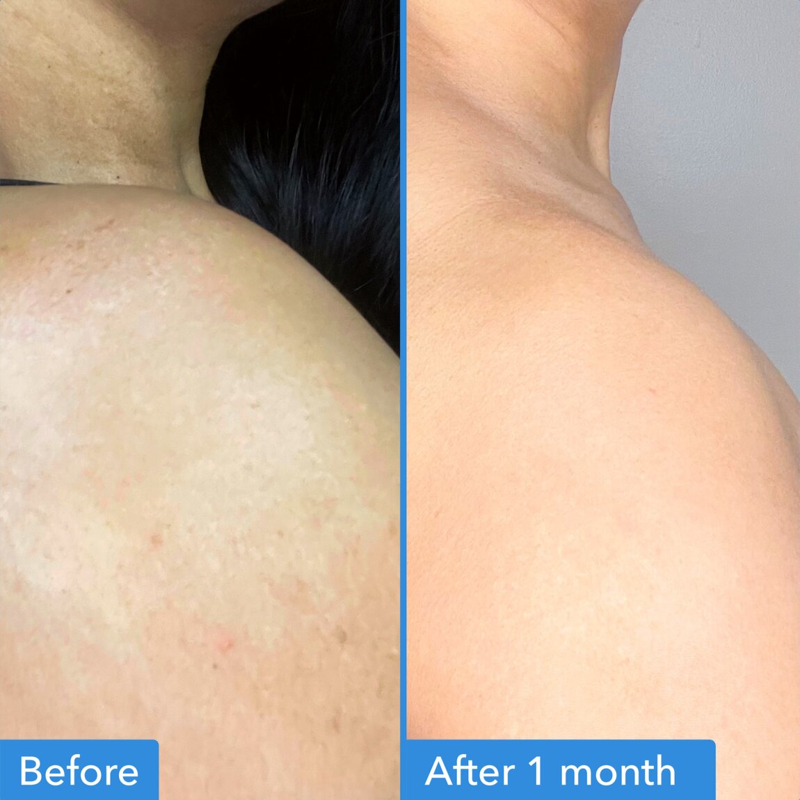 discoloration-correcting-body-treatment-i8 zb_p.jpg